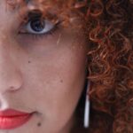 O que é Melasma