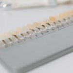 Perda dentária: 9 efeitos no corpo e as formas de repor os dentes! 15 Perda dentária